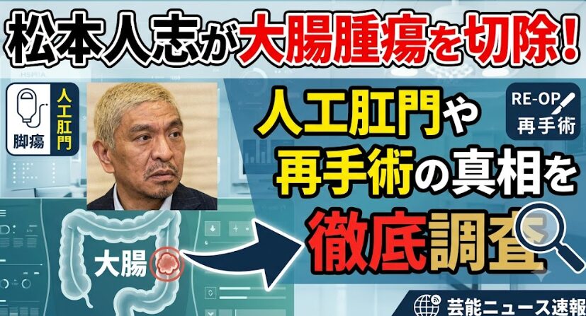 松本人志が大腸腫瘍を切除！人工肛門や再手術の真相を徹底調査